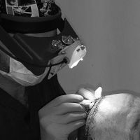 Imagen del doctor Xavier &Aacute;lvarez realizando una cirug&iacute;a de injerto capilar.
